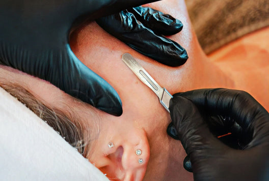 Dermaplaning